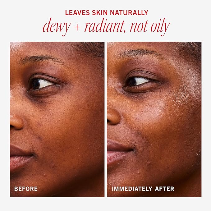 First Aid Beauty - Hydrating Dewy Gel Cream Lightweight Oil-Free Facial Moisturizer with Hyaluronic Acid and Ceramides Helps Reduce Excess Oil Build Up &amp Improve Skins Hydration 1.9 FL oz