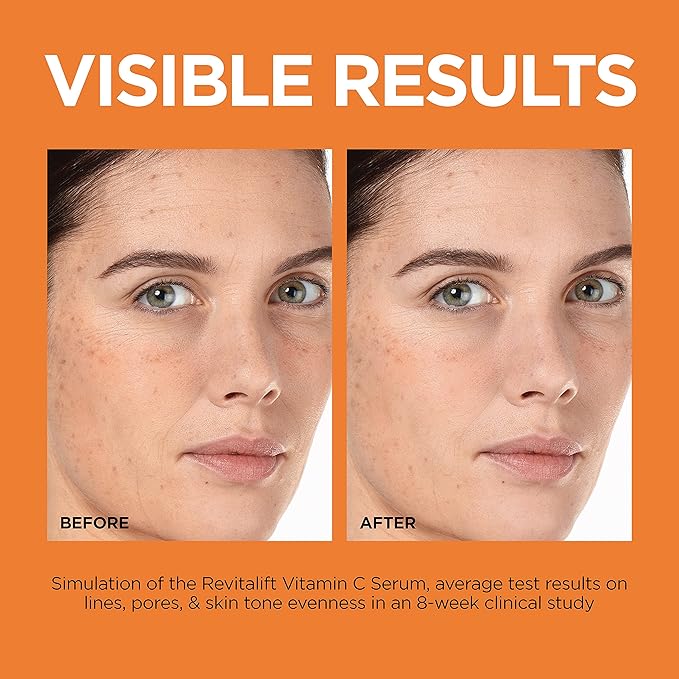L'Oreal Paris Revitalift 12% Pure Vitamin C Serum Brightening Serum For Face with Vitamin E Salicylic Acid 1 oz + Moisturizer Sample