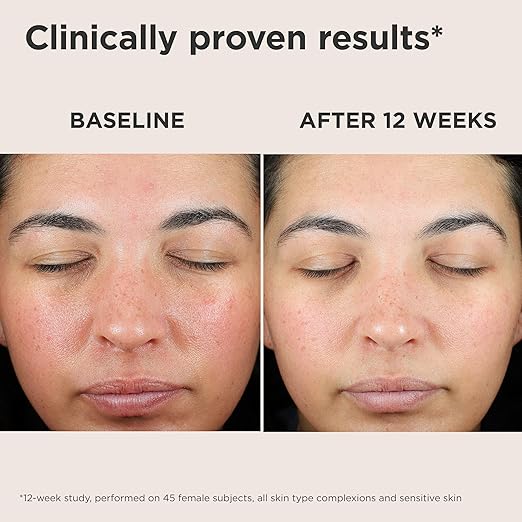 EltaMD UV Skin Recovery Face Sunscreen with Zinc Oxide All Mineral Safe for Sensitive Skin SPF 50