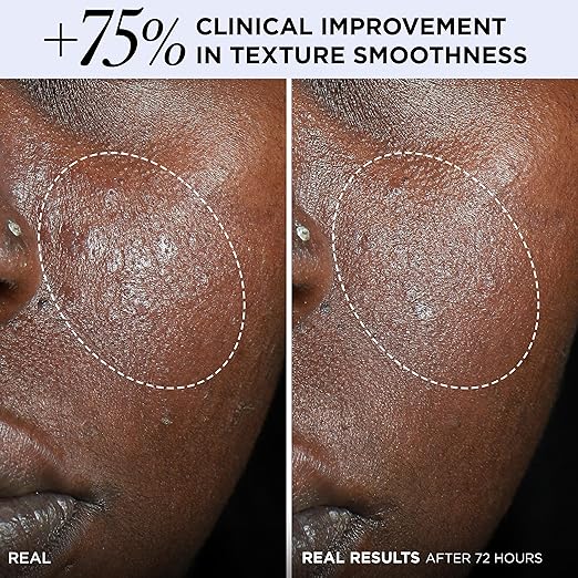 IT Cosmetics Confidence in a Cream Barrier Boost - Skin Barrier Repair Daily Face Moisturizer - Clinically Smoother Softer Skin After 1 Use - Fragrance-Free 100HR Hydration with Ceramide